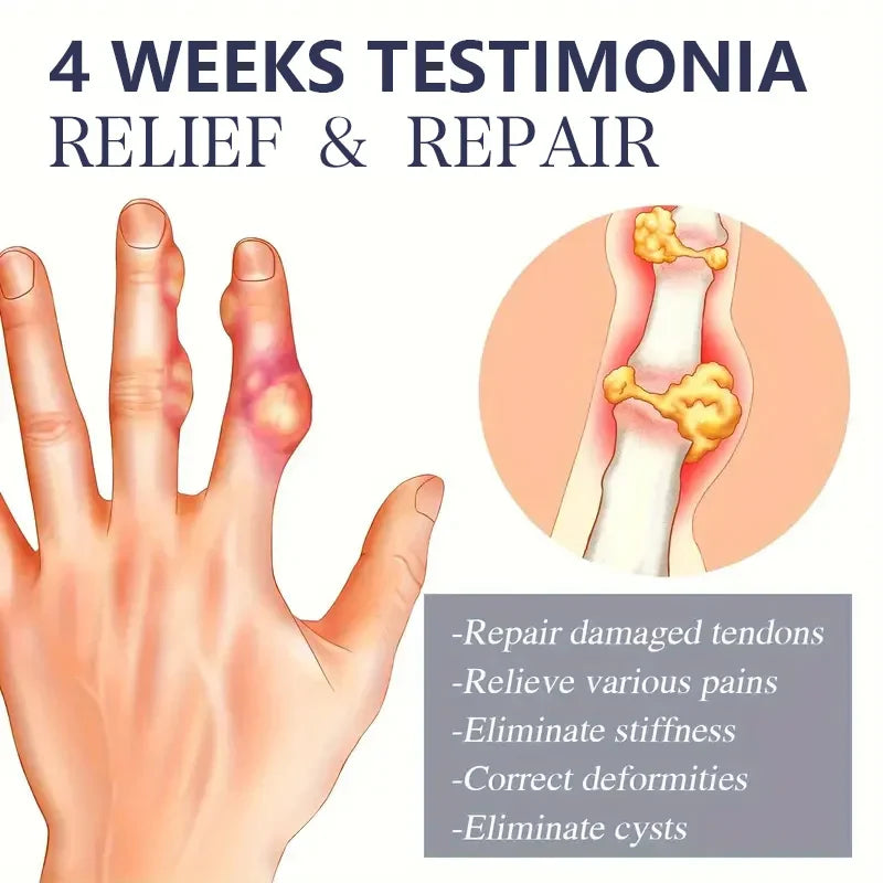 Bee Venom Joint Lotion — Hypoallergenic & Fast-Absorbing Joint Recovery Care